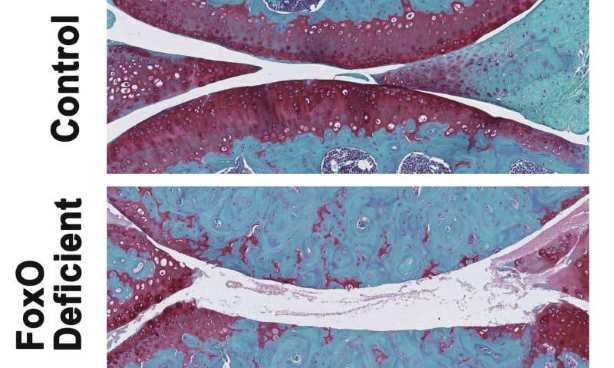 Proteínas clave controlan el riesgo de artrosis durante el envejecimiento