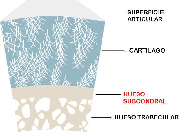 El hueso subcondral y el desarrollo de la artrosis